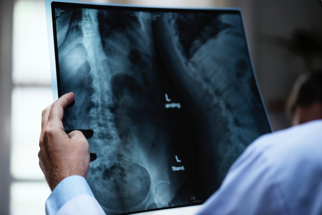 xray